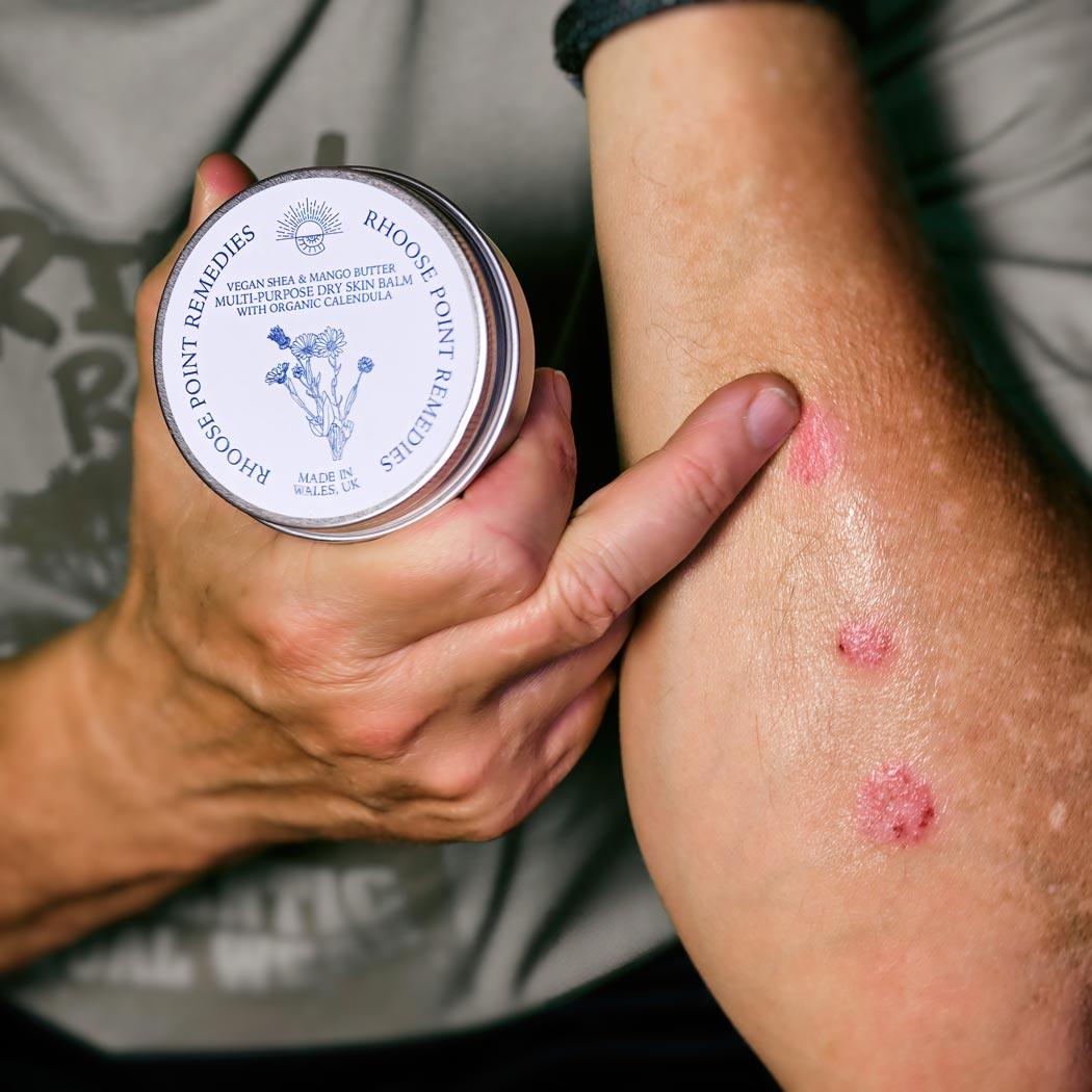 Dry Skin Balm on Model