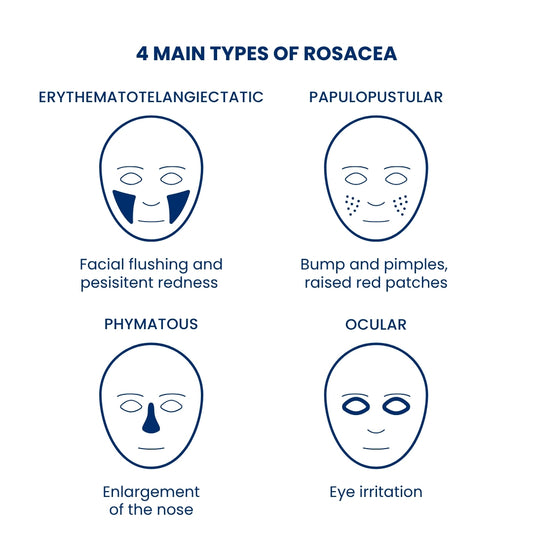 Organic rosacea cream portrait