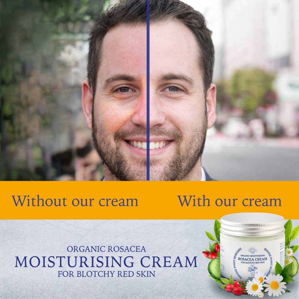 Rosacea cream organic product