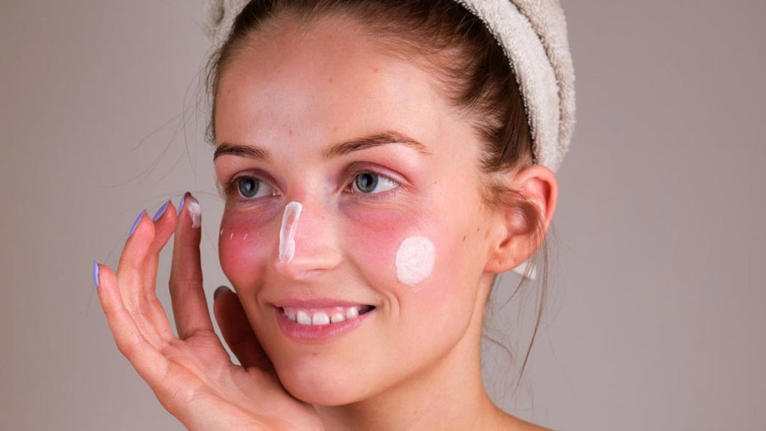 What is a natural treatment for rosacea