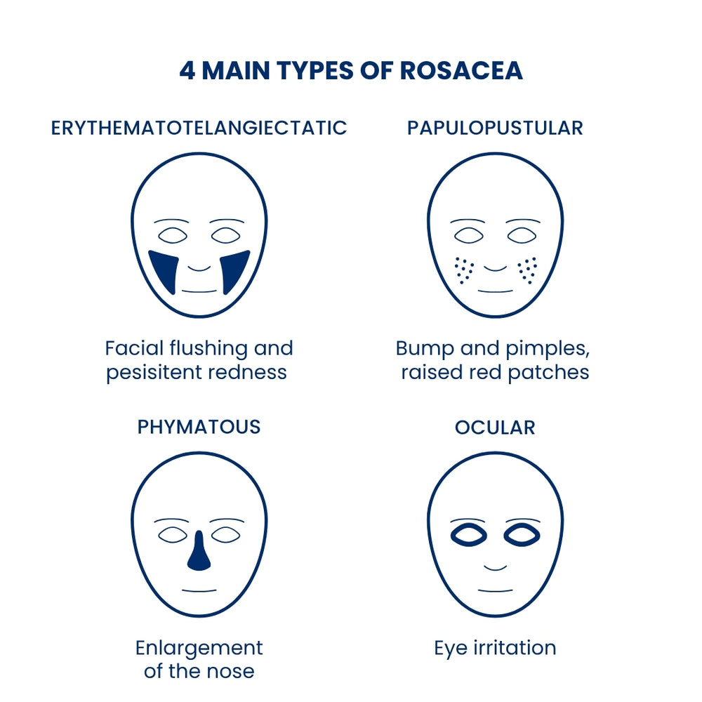 Organic rosacea cream portrait