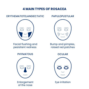 Rosacea skincare natural remedy
