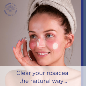 Organic Rosacea Cream Moisturiser